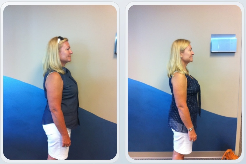 Jeanie before and after